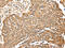 Mitogen-Activated Protein Kinase 7 antibody, CSB-PA556658, Cusabio, Immunohistochemistry paraffin image 