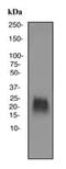 Teratocarcinoma-Derived Growth Factor 1 antibody, ab108391, Abcam, Western Blot image 
