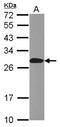 Anaphase Promoting Complex Subunit 10 antibody, NBP2-15423, Novus Biologicals, Western Blot image 
