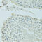 Bromodomain Containing 3 antibody, 18-597, ProSci, Immunohistochemistry paraffin image 