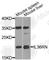 Interleukin 36 Receptor Antagonist antibody, A8205, ABclonal Technology, Western Blot image 