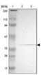 PDZ And LIM Domain 2 antibody, NBP1-85800, Novus Biologicals, Western Blot image 