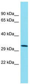 Transmembrane Protein 241 antibody, TA333594, Origene, Western Blot image 