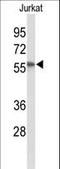 SACM1L antibody, LS-B11784, Lifespan Biosciences, Western Blot image 