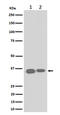 ELOVL Fatty Acid Elongase 5 antibody, M03615, Boster Biological Technology, Western Blot image 