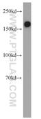 Platelet Derived Growth Factor Receptor Beta antibody, 13449-1-AP, Proteintech Group, Western Blot image 
