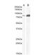 Cholecystokinin B Receptor antibody, NB100-2803, Novus Biologicals, Western Blot image 