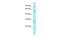 Proton-coupled amino acid transporter 1 antibody, A05386, Boster Biological Technology, Western Blot image 