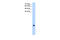 Transmembrane protein 75 antibody, 31-362, ProSci, Enzyme Linked Immunosorbent Assay image 