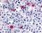 Fanconi anemia group J protein antibody, GTX70433, GeneTex, Immunohistochemistry paraffin image 