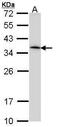 Major Histocompatibility Complex, Class II, DR Alpha antibody, PA5-29814, Invitrogen Antibodies, Western Blot image 