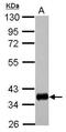 Major Histocompatibility Complex, Class II, DP Alpha 1 antibody, PA5-28037, Invitrogen Antibodies, Western Blot image 