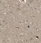 Myotrophin antibody, FNab05419, FineTest, Immunohistochemistry paraffin image 