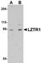 Leucine Zipper Like Transcription Regulator 1 antibody, NBP1-77121, Novus Biologicals, Western Blot image 