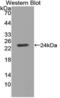 Hepatocellular carcinoma-associated protein TD26 homolog antibody, MBS2027267, MyBioSource, Western Blot image 