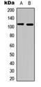 Phosphatidylinositol-4,5-Bisphosphate 3-Kinase Catalytic Subunit Alpha antibody, orb256751, Biorbyt, Western Blot image 
