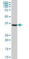 Proteasome 26S Subunit, Non-ATPase 6 antibody, H00009861-B01P, Novus Biologicals, Western Blot image 