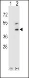 Decorin antibody, LS-C99324, Lifespan Biosciences, Western Blot image 
