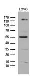 Nuclear Receptor Coactivator 7 antibody, CF810476, Origene, Western Blot image 