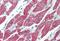 Activin A Receptor Like Type 1 antibody, MBS243221, MyBioSource, Immunohistochemistry paraffin image 