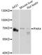 P21 (RAC1) Activated Kinase 4 antibody, A2782, ABclonal Technology, Western Blot image 