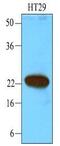 Calcium And Integrin Binding 1 antibody, GTX53699, GeneTex, Western Blot image 