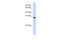 Tubulin Polyglutamylase Complex Subunit 2 antibody, 26-990, ProSci, Enzyme Linked Immunosorbent Assay image 