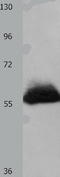 HPSE1 antibody, TA323272, Origene, Western Blot image 