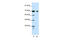 Tripartite Motif Containing 32 antibody, 28-983, ProSci, Western Blot image 