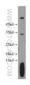 Tropomyosin 2 antibody, 11038-1-AP, Proteintech Group, Western Blot image 