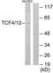 Transcription Factor 4 antibody, TA314598, Origene, Western Blot image 