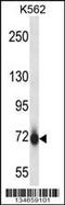 P21 (RAC1) Activated Kinase 5 antibody, MBS9205149, MyBioSource, Western Blot image 