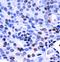 Nuclear Factor Kappa B Subunit 2 antibody, orb14431, Biorbyt, Immunohistochemistry paraffin image 