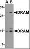 DNA Damage Regulated Autophagy Modulator 1 antibody, orb88408, Biorbyt, Western Blot image 