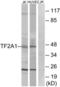 General Transcription Factor IIA Subunit 1 antibody, LS-B9925, Lifespan Biosciences, Western Blot image 