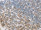 MutS Homolog 6 antibody, CSB-PA051370, Cusabio, Immunohistochemistry paraffin image 