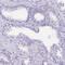 DLEC1 Cilia And Flagella Associated Protein antibody, HPA019077, Atlas Antibodies, Immunohistochemistry frozen image 