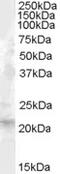 Secretoglobin Family 2A Member 2 antibody, 45-859, ProSci, Immunohistochemistry paraffin image 