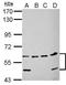 Nuclear Prelamin A Recognition Factor antibody, GTX115913, GeneTex, Western Blot image 