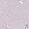 Desmoplakin antibody, HPA054950, Atlas Antibodies, Immunohistochemistry paraffin image 