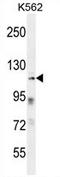 Zinc Finger Protein 99 antibody, AP54735PU-N, Origene, Western Blot image 