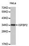 Insulin Like Growth Factor Binding Protein 2 antibody, orb153959, Biorbyt, Western Blot image 