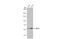 AKT Serine/Threonine Kinase 2 antibody, GTX128458, GeneTex, Western Blot image 