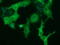 Dynein Cytoplasmic 1 Light Intermediate Chain 1 antibody, LS-C115547, Lifespan Biosciences, Immunofluorescence image 