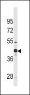 Wnt Family Member 4 antibody, MBS9212652, MyBioSource, Western Blot image 