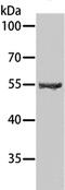 Spermatogenesis Associated 6 antibody, PA5-50280, Invitrogen Antibodies, Western Blot image 