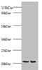 Peroxiredoxin 1 antibody, A52589-100, Epigentek, Western Blot image 