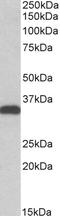 Carbonyl Reductase 3 antibody, EB05519, Everest Biotech, Western Blot image 