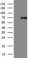 Thyroid Hormone Receptor Alpha antibody, CF805056, Origene, Western Blot image 