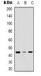 ERGIC And Golgi 3 antibody, LS-C368855, Lifespan Biosciences, Western Blot image 